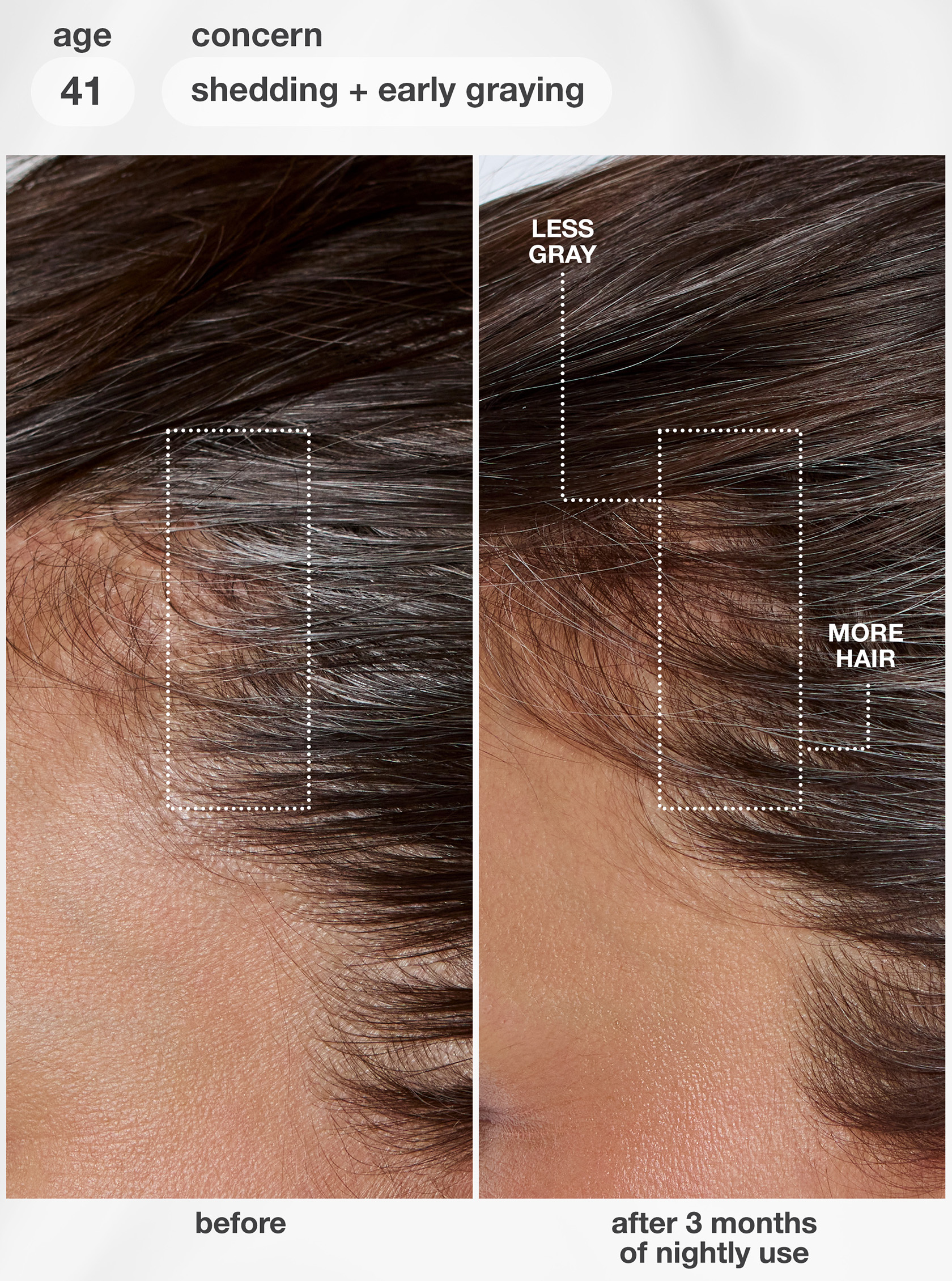 K18 FutureIQ before and after, 3 months of nightly use