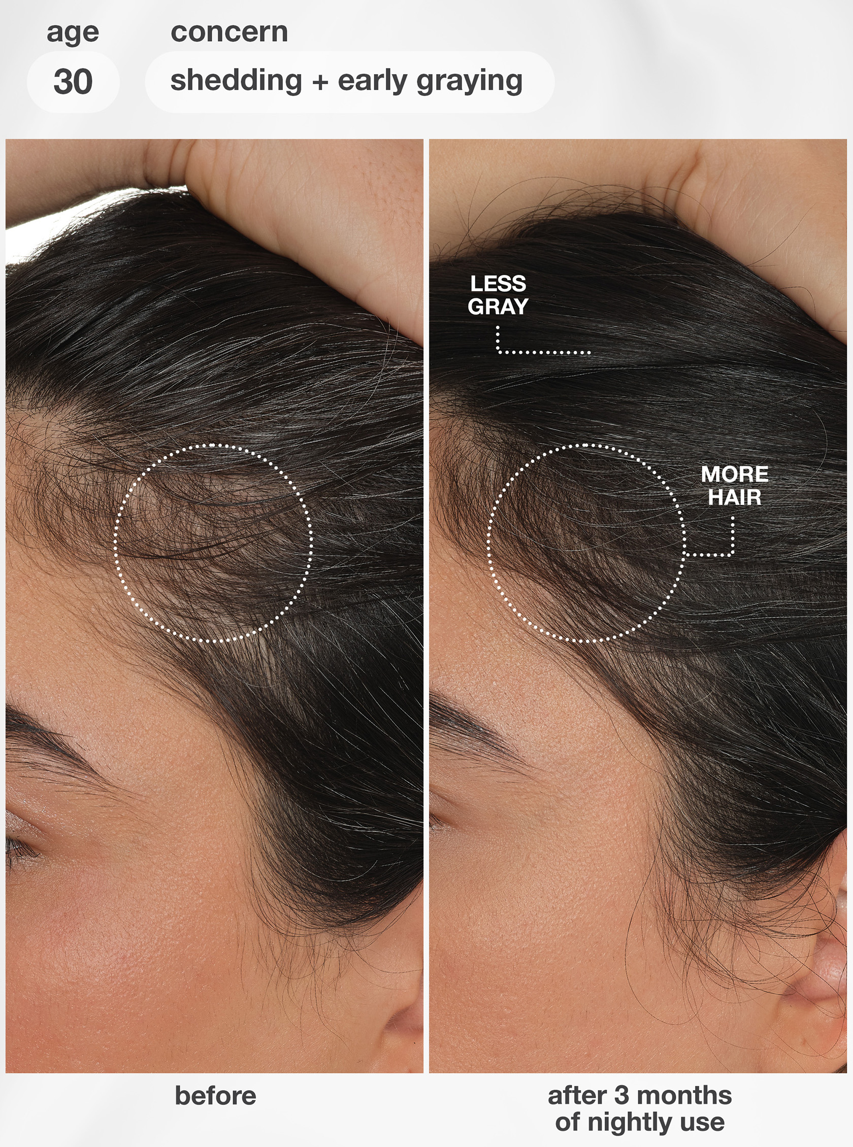 K18 FutureIQ before and after, 3 months of nightly use